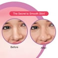 thumbnail image 4 of DR.RASHEL Strawberry Nose Strips , 20 Pcs, 4 of 5