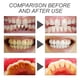 thumbnail image 4 of Cuidado dental, Cuidado dental, Polvo de carbón activado natural, Polvo blanqueador de dientes, Polvo de carbón activado, Pasta dental de carbón activado, Eliminación de encías, Aliento refrescante,, 4 of 9