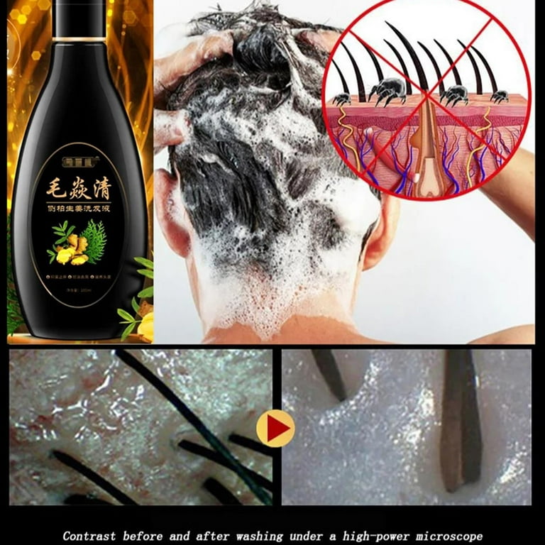 Hair follicle shampoo discount
