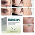 thumbnail image 3 of Silicone Scar Tape(4*300cm) - Silicone Scar Sheets Strips for Professional Scar Removal, C-Section, Surgery, Burns, Keloid & Acne Scars, 3 of 5