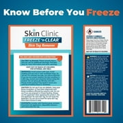 Skin Clinic FREEZE n CLEAR Skin Tag Remover
