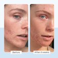 thumbnail image 4 of Crema hidratante First Aid Beauty Ultra Repair, 355 ml, 4 of 9