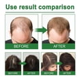 thumbnail image 4 of Fiudx Spray de Romero, Brurma Hidratante En Cabello, Champú Anticaspa, Sérum Potenciador de Elasticidad, Producto para Peinar, para Todo Tipo de Cabello, Fórmula de Uso Diario, Formato de Viaje de 30, 4 of 7