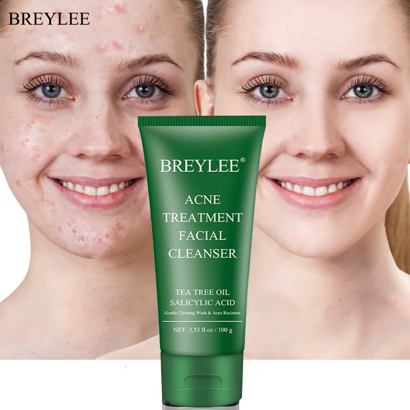 Buy BREYLEE Acne Face Wash Acne Treatment Facial Cleanser Tea Tree Acne