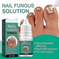 thumbnail image 2 of Fungal Nail Treatment For Toenail Extra Strong, Ingrown Toenail Treatment Nail Care Oils, Toenail Fungus Treatment, 2 of 5