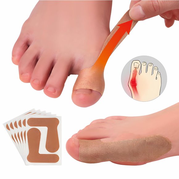 20 PCS corrector de juanete, parches autoadhesivos, alivio del dolor, para hombres y mujeres