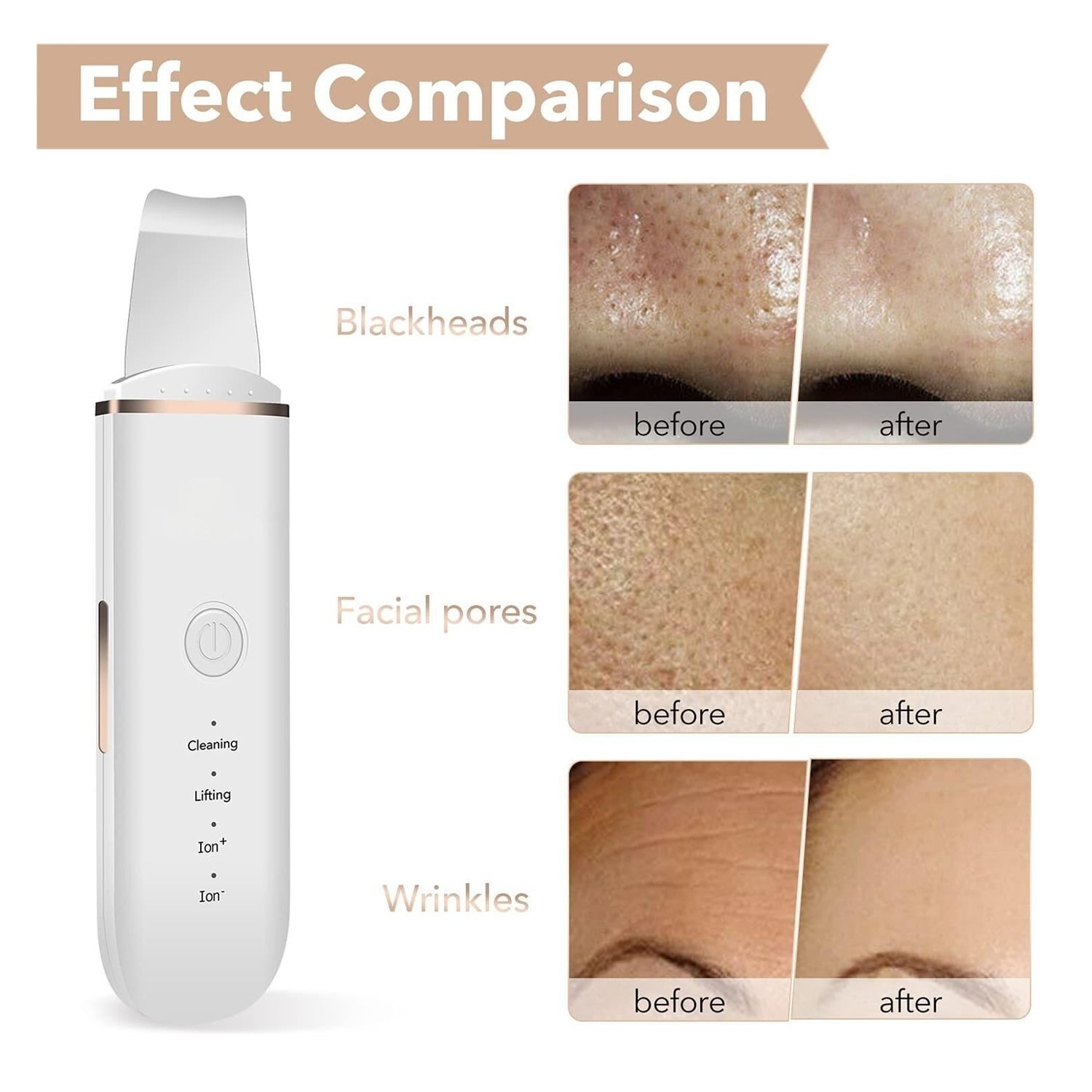Skin Scrubber Face Skin Spatula Facial Scrubber Spatula for Deep Cleansing Blackhead Remover Pore Cleaner with 4 Modes (White)