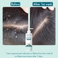 thumbnail image 4 of WishCare Hydrating AHA BHA Anti Dandruff Shampoo For Women & Men-Paraben & Sulphate Free Shampoo 250ml, 4 of 7