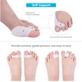 thumbnail image 1 of Toe Corrector, Toe Straightener, Comfortable For Loafers Sneakers, 1 of 8