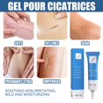 thumbnail image 4 of Scar Removal Stretch Marks and Burns Mark Removal, 4 of 8