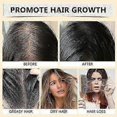 thumbnail image 5 of Batana Oil for Hair Growth, 4-in-1 Liquid Batana Oil, with Rosemary Oil Castor Oil Pumpkin Seed Oil,for All Hair Types, 5 of 5