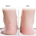 thumbnail image 3 of Herwey 1 Pair Silicone Socks Foot Anti-cracking Protector Foot Care Tool Prevention Socks , Silicone Prevention Socks, Foot Protector, 3 of 8