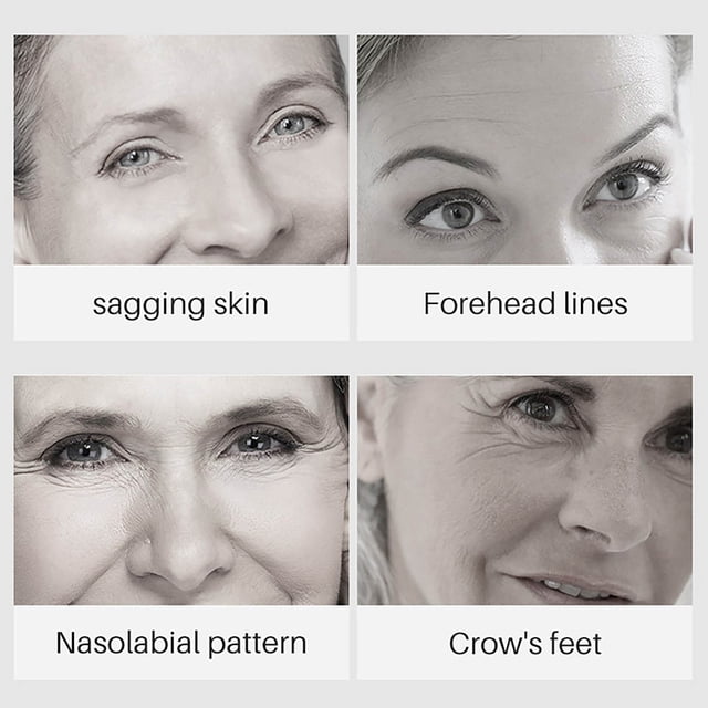 , , DarkSpot , Anti-aging, Fade Fine Lines, Wrinkles, Skin Moisturizing 30ml