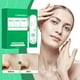 thumbnail image 4 of Xihbxyly Oferta del día Liquidación Mascarilla facial en centella asiática Mascarilla facial en burbujas purificadora de poros en centella asiática que limpia y absorbe la suciedad de los puntos negr, 4 of 7