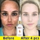 thumbnail image 3 of Suero abrillantador para la cara, producto coreano, eliminador de manchas oscuras, pecas, aclara la marca del acné, blanqueamiento, mejora la luminosidad, hidrata la piel, 3 of 5