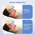 thumbnail image 3 of Anti-Snoring Mouthpiece, Anti-Snoring Device Mouth Guard For Comfort, 3 of 8