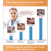 LANBENA Nail Repair Essence Serum Remove Onychomycosis Fungal Nail Treatment USA