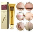 thumbnail image 3 of Scar Repairing Gel, Nourishing Scar Removal Cream Soothing  For Burns Cuts, 3 of 8