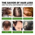 thumbnail image 3 of Jaysuing hair care solution - gentle nourishing scalp massage, moisturizes & smooths hair, hair spray for for daily skin care daily care, 3 of 5
