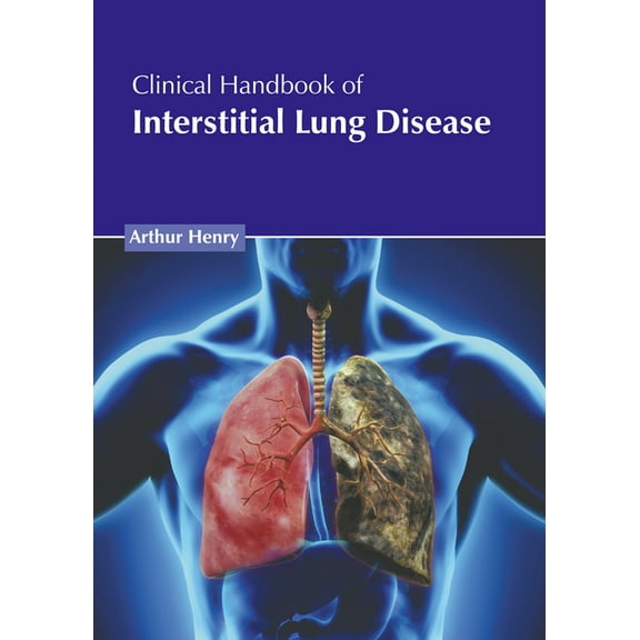 Clinical Handbook of Interstitial Lung Disease, (Hardcover)