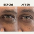 thumbnail image 4 of Parches para Ojeras Papatui 6 unidades para Hombre - Anti-Bolsas y Círculos Oscuros, 4 of 9