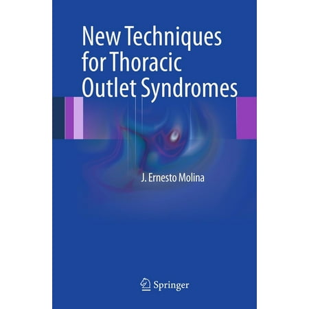New Techniques for Thoracic Outlet Syndromes - (Best Exercises For Thoracic Outlet Syndrome)