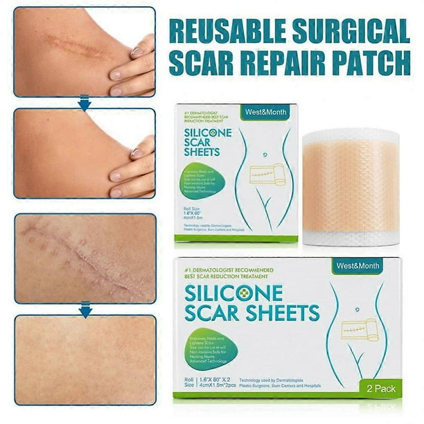 1pcs 4*150cm Silicone Scar Removal Gel Sheet Efficient Repair Surgery Acne Burn Scars