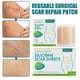 thumbnail image 4 of 150cm Silicone Gel Scar Sheet Patch Treatment Removal Tape Acne Trauma Burn Scar, 4 of 5