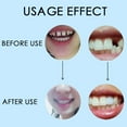thumbnail image 4 of Pegamento Dental de 10/100g pegamento temporal sólido para dentadura pegamento para huecos de dientes pegamento para blanqueamiento Dental, 4 of 5