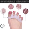thumbnail image 3 of Toe Spacers(2 Pair), Gel Toe Separators to Correct Toes, Bunion Corrector for Women Men Toe Spacer Hammer Toe Straightener Toe Stretcher Big Toe Separators (White), 3 of 4