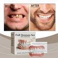 thumbnail image 4 of Custom Dental Guard Set for Teeth Alignment Comfortable and Nearly Invisible Wear, 4 of 8