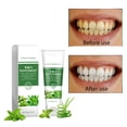 thumbnail image 2 of Pasta de dientes iluminadora para encías sensibles | Fórmula suave no irritante | Limpieza profunda | Elimina las manchas | Menta fresca | Nutre las encías | Blanqueamiento dental | 1 tubo |, 2 of 7