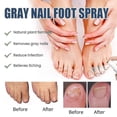 thumbnail image 3 of South moon onychomycosis repair spray moisturizes and cleans odor onychomycosis soft nail dry na, 3 of 5