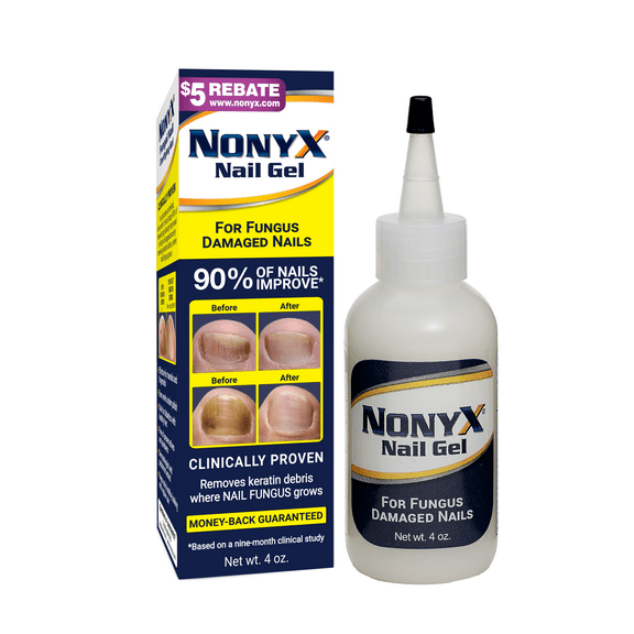 Nonyx Nail Gel Restores Fungus Damaged Nails, a Clinically Proven Toenail Treatment, 90% of Nails Improve, Money-Back Guaranteed, 4 oz