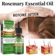 thumbnail image 5 of 30ml Aceite para el crecimiento del cabello Suero antipérdida de romero natural Productos para el cuidado del cabello, 5 of 9