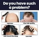 thumbnail image 4 of Fiudx Solución Nutritiva Capilar con Extracto de Jengibre Polygonum. Revitaliza La Densidad Capilar, Promueve La Salud Del Cuero Cabelludo y Reduce La Caída Del Cabello. Uso Diario para Hombres y Muj, 4 of 6