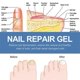 thumbnail image 4 of Healio Nail Treatment Gel Nail Care Gel Nail Thickening Nail Brightening Nail, 4 of 5