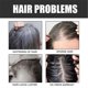thumbnail image 5 of Liquidación Jabón ennegrecedor para cabello blanco Champú anticaída natural para cabello blanco, 5 of 5