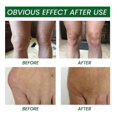 thumbnail image 2 of Arthritis Treatment Gel Relieve Muscles Soreness Lumbar Pain Relieve Chinese Medical Plaster Body Health Care Analgesic Gel, 2 of 5