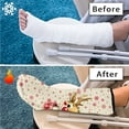 thumbnail image 7 of COEQINE Christmas Deer 2 Pack Leg Cast Covers Outdoor Leg Protection Cover Soft Cast and Bandage Protector Anti Scratch Broken Leg Shower Cast Cover Xmas Gifts for Kids Girls Size L, 7 of 7