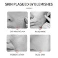 thumbnail image 4 of 50ml Pibamy Black Spot Remover, Pibamy Black Spot Remover Chino, Vitamin C Face Serum, 4 of 5