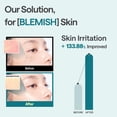thumbnail image 4 of Mascarilla Mediheal Madecassoside Essential Bemish Repair, 4 of 7