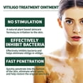 thumbnail image 4 of 30g White Spots Treatments Cream Improve Skin Pigmentation Cream for Body Skin Repair, 4 of 5