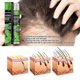 thumbnail image 5 of Spray para el crecimiento del cabello Líquido para el crecimiento Nutrición sólida para el cabello Hidratación del cabello - 3668951825515, 5 of 5