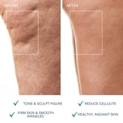 FOREO Bear 2 Body Microcurrent Massager – Body Sculpting & Cellulite Treatment Device - Evergreen