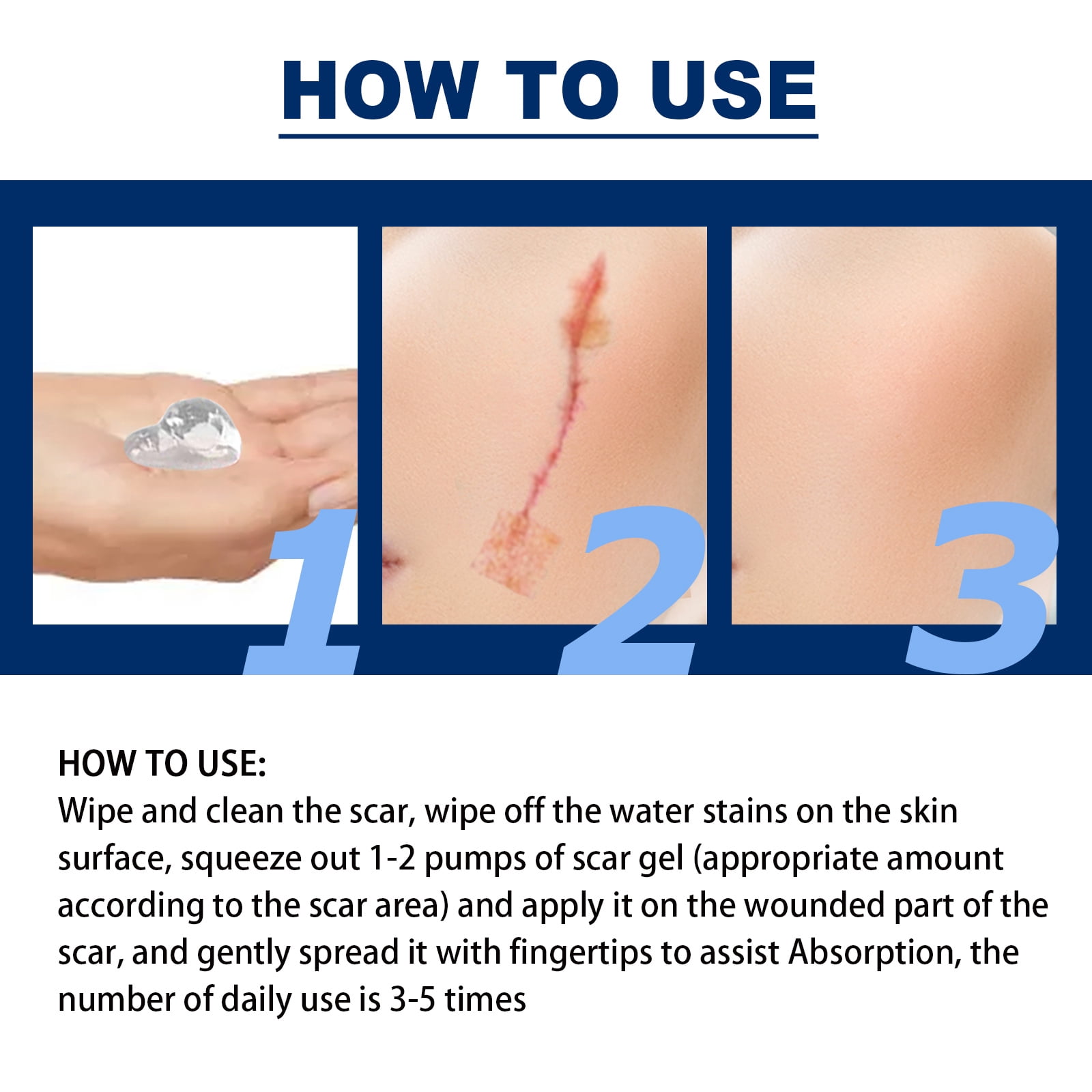 Alvantor Silicone Scar Gel for C-Section, Stretch Marks, Acne, and Surgery Scars