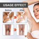 thumbnail image 4 of Crema Para Eliminar Melanina, Suave, Mejora Las Líneas Secas, Fácil De Aplicar, Absorción Rápida, Crema Blanqueadora Para Piel Oscura, 2 Piezas, Prevención Grasa, Ampliamente, 4 of 7