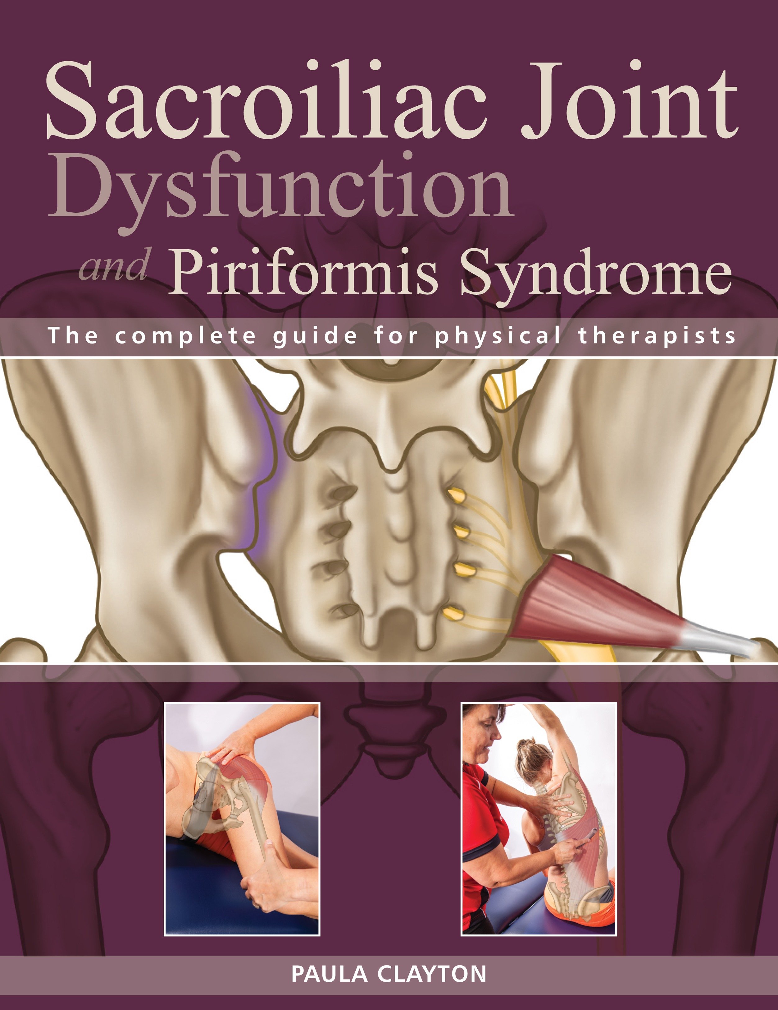 Sacroiliac Joint Dysfunction And Piriformis Syndrome The Complete Guide For Physical Therapists Paperback Walmart Com Walmart Com Sacroiliac Joint Dysfunction And Piriformis Syndrome The Complete Guide For Physical Therapists Paperback Walmart Com Walmart Com