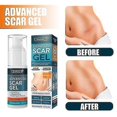 thumbnail image 2 of 3pcs Scar Gel Scar Repair Gel 30ml, 2 of 5