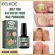 thumbnail image 1 of Onicomicosis Líquido Manos Y Pies Onicomicosis Cuidado Reparación Degerm Onicomicosis Líquido Espesar Uñas Suaves-15ml, 1 of 5
